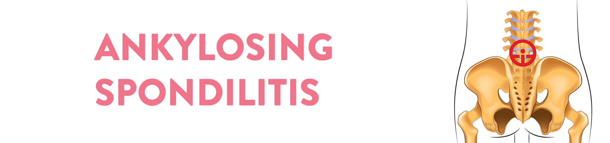 ANKYLOSING SPONDILITIS Banner