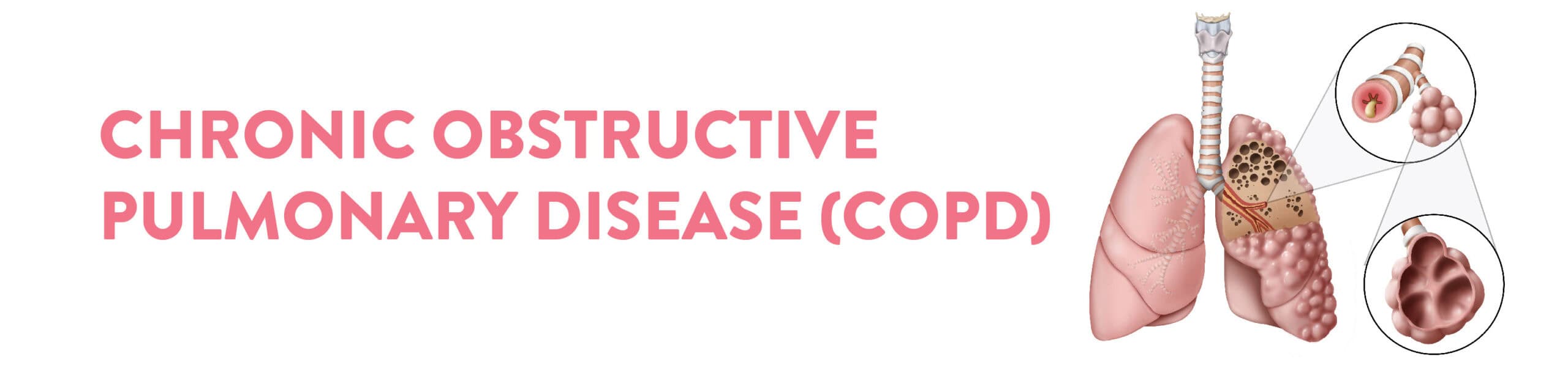 All you need to know about COPD disease Featured Image