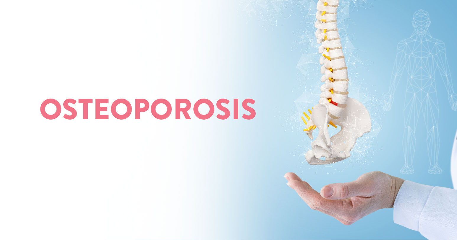 Osteoporosis - Causes, Symptoms and Treatment