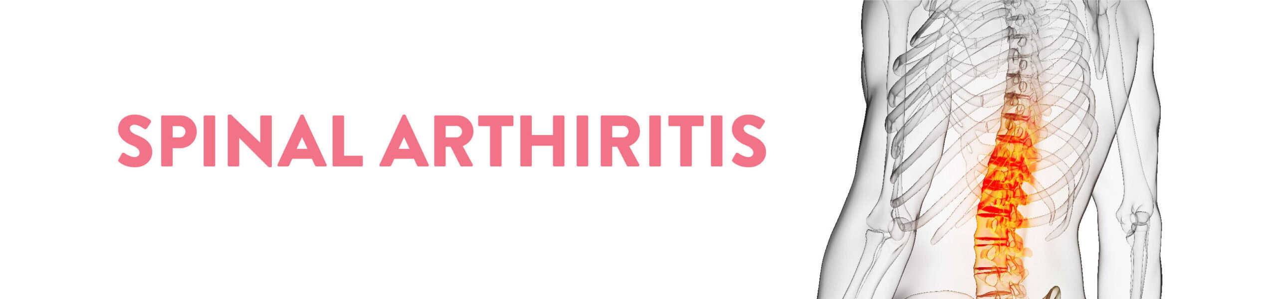 SPINAL ARTHIRITIS Banner