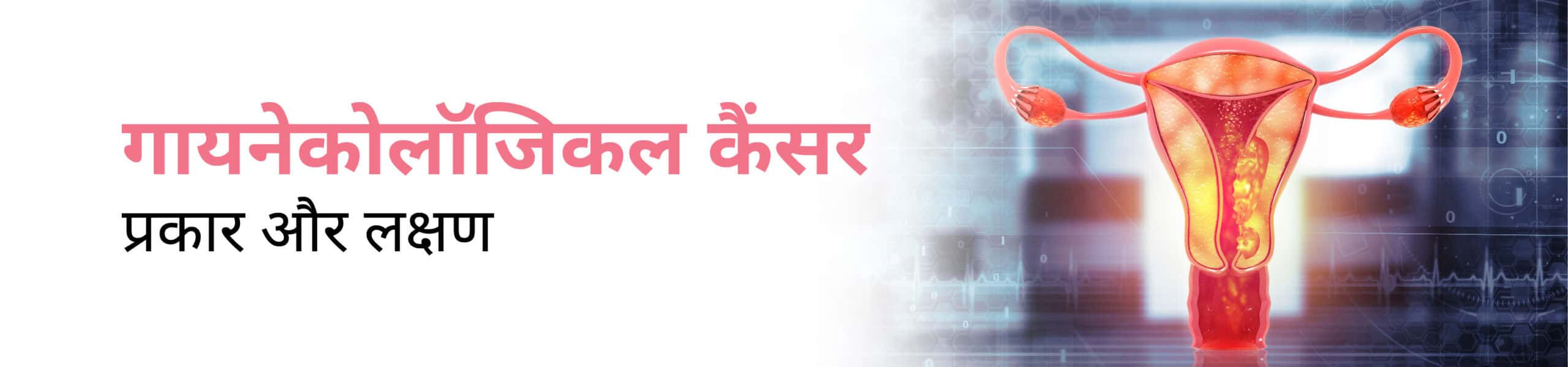 गायनेकोलॉजिकल कैंसर के प्रकार और लक्षण Banner Image