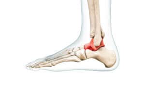 Anatomy of a normal ankle