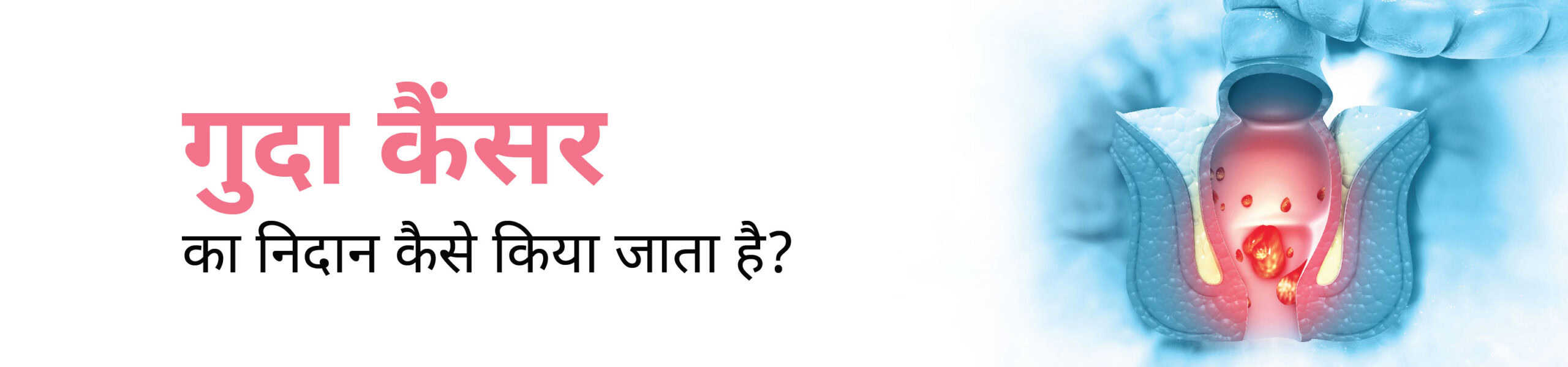 गुदा कैंसर का निदान कैसे किया जाता है?