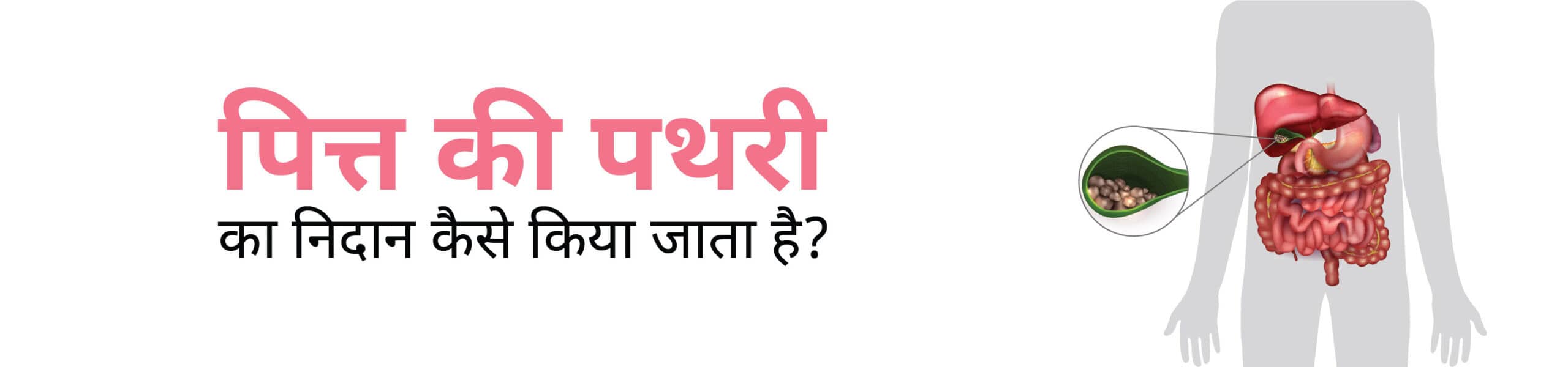 जाने गॉल ब्लैडर स्टोन या पित्ताशय की पथरी की जाँच या निदान कैसे किया जा सकता है