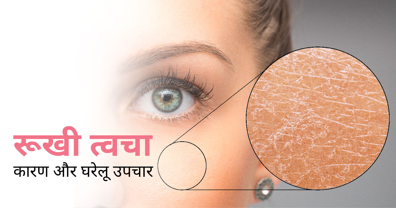 dry skin in hindi