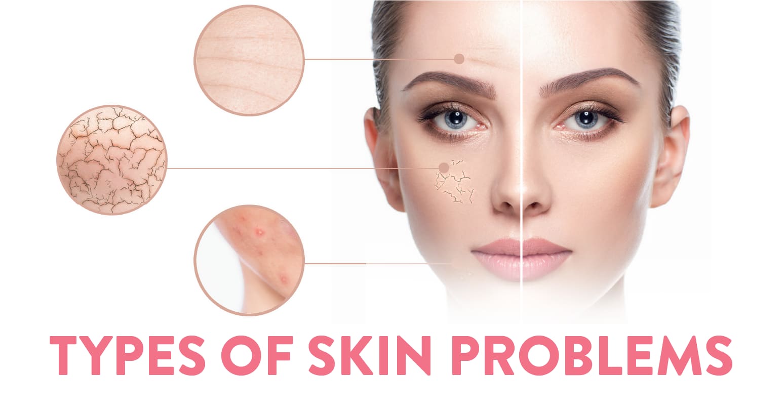 Types of skin problems & It's Solution