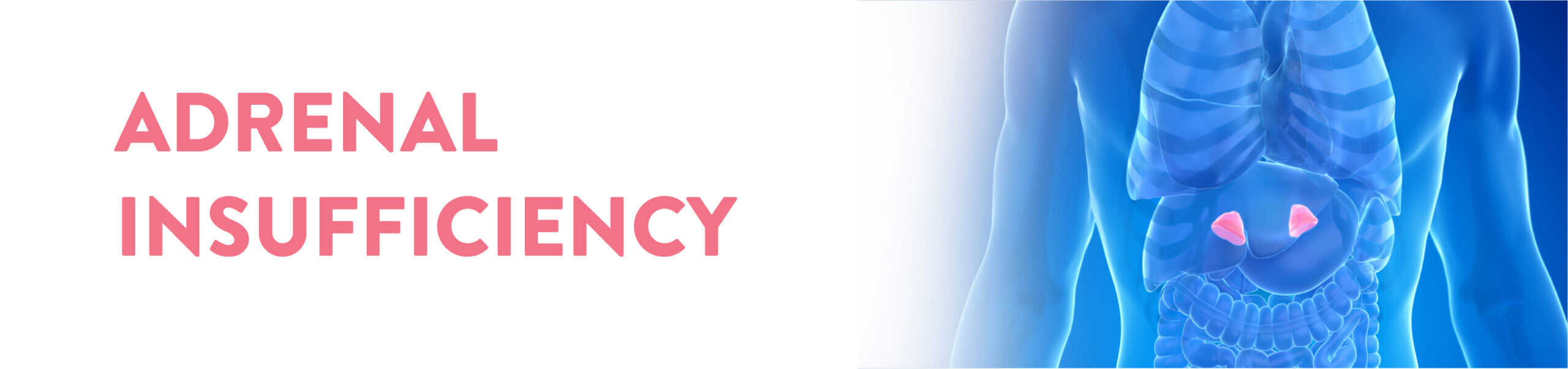 Adrenal Insufficiency