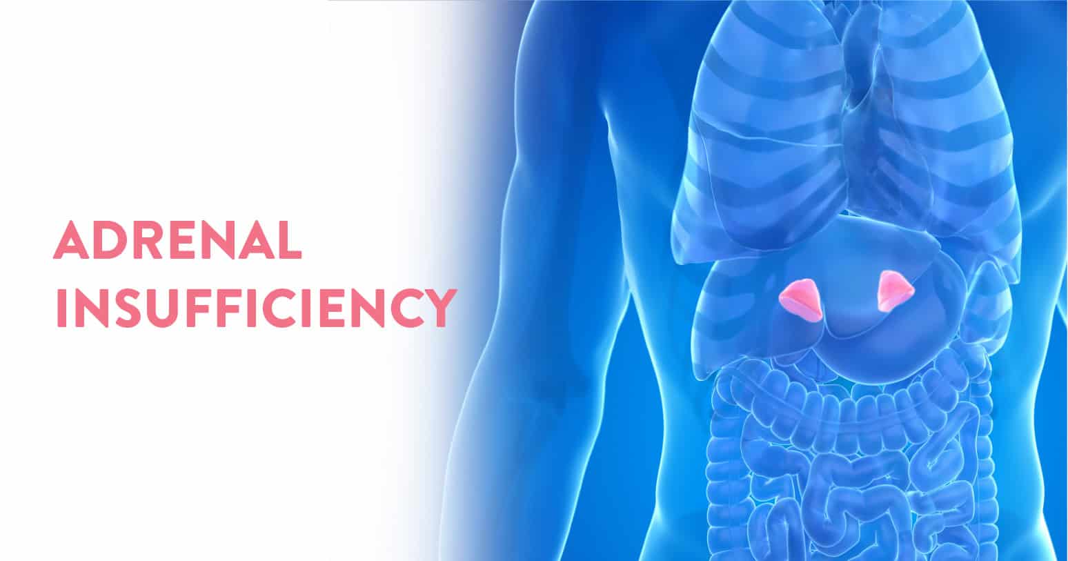 Adrenal Insufficiency