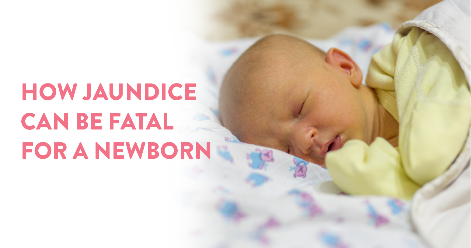 how jaundice can be fatal for a newborn