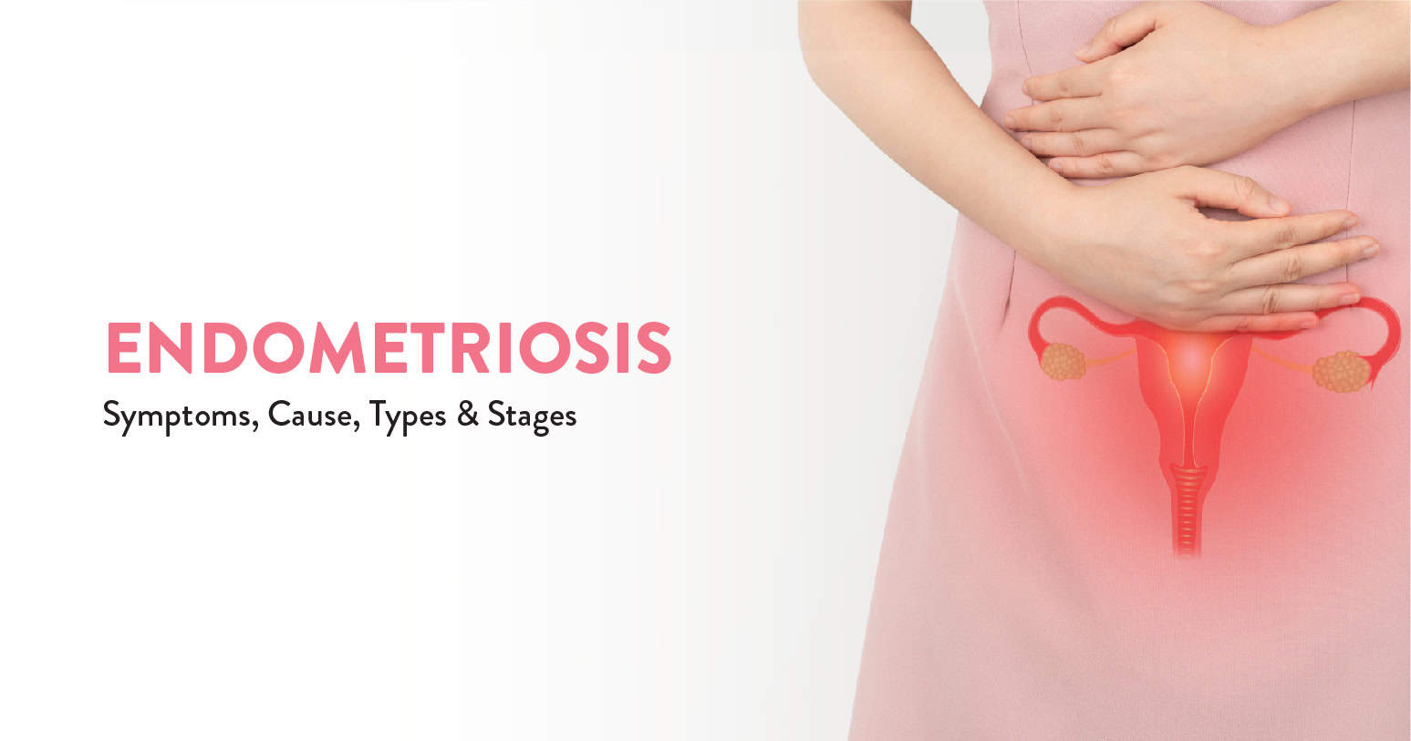 Endometriosis - Types, Symptoms, Causes and treatment