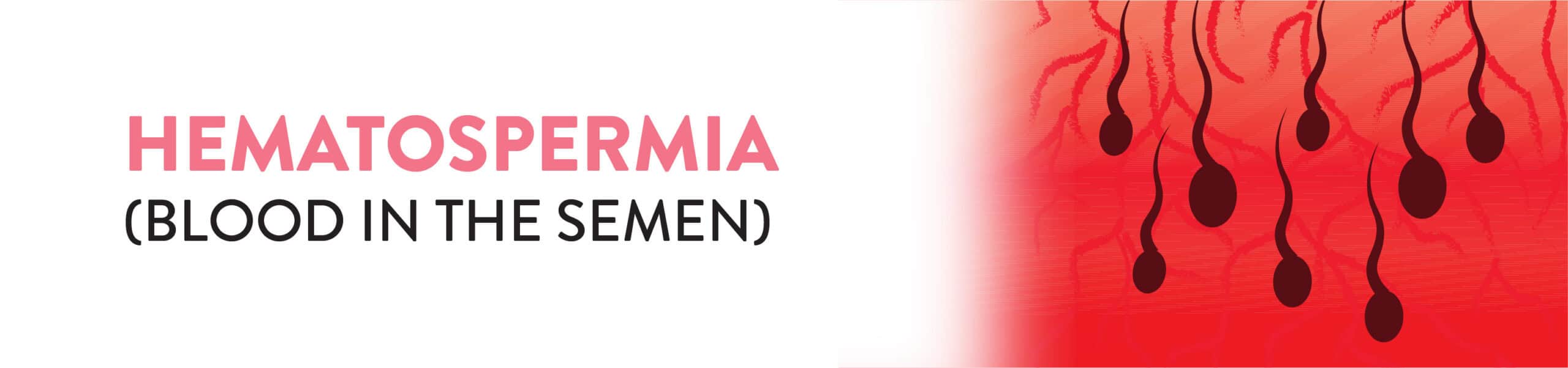 Hematospermia