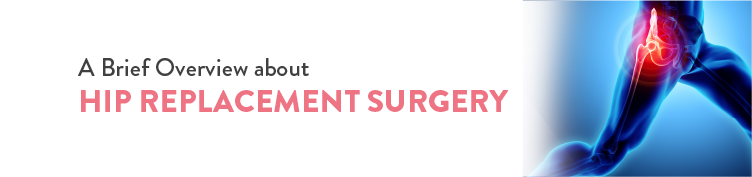 Hip Replacement Surgery