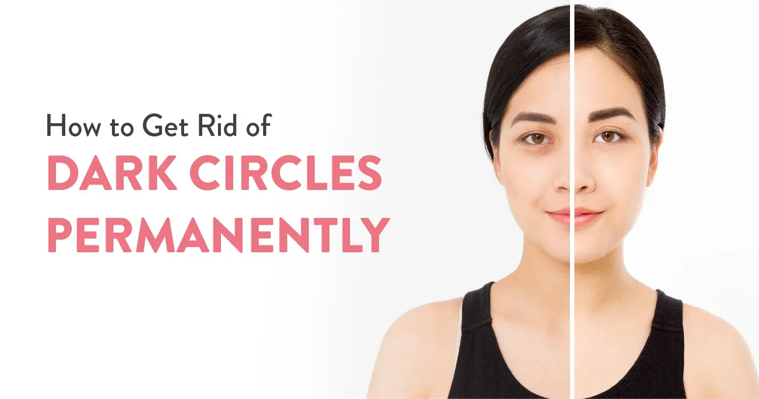 Get Rid of Dark Circles