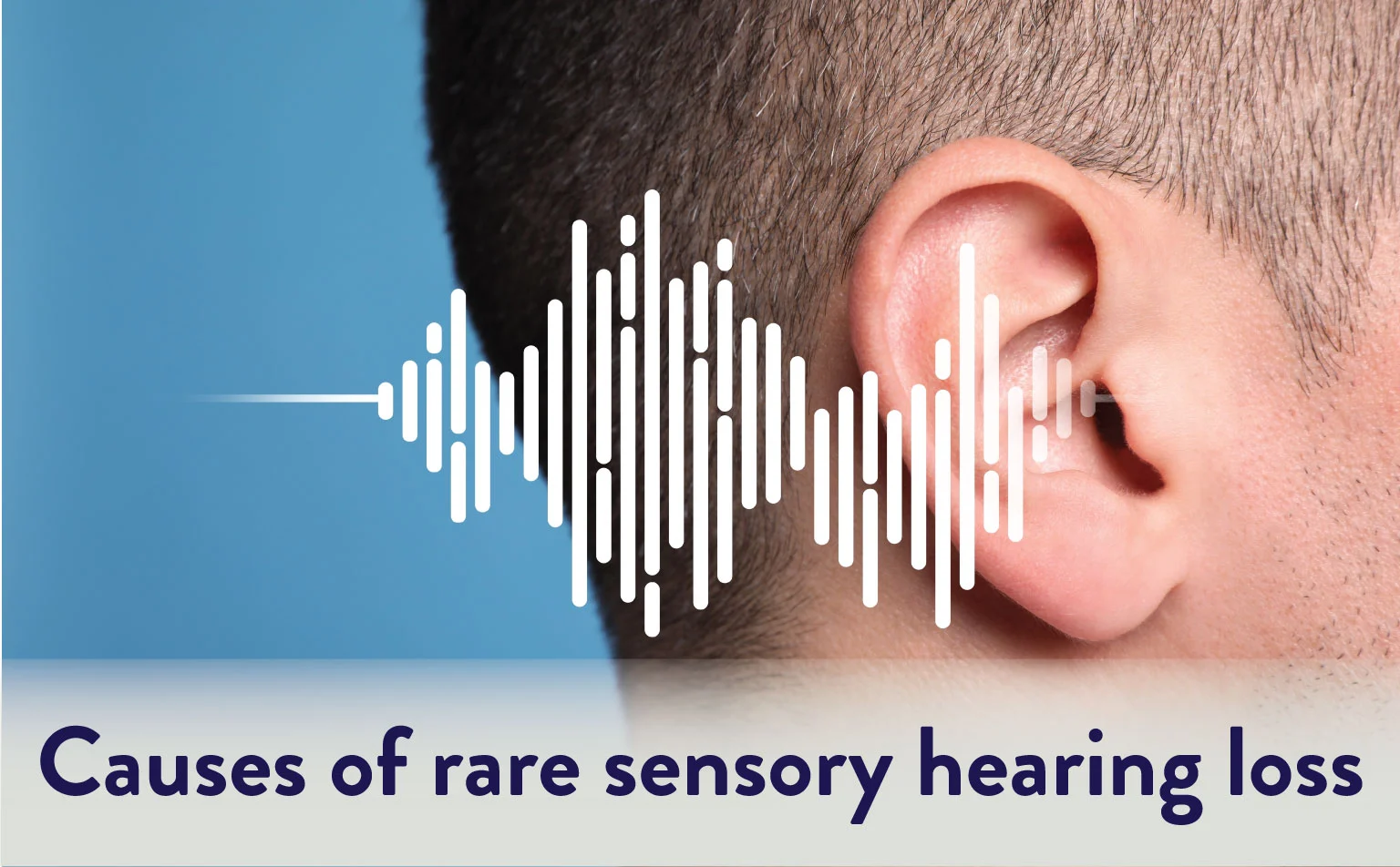 Causes of Rare Sensory Hearing Loss