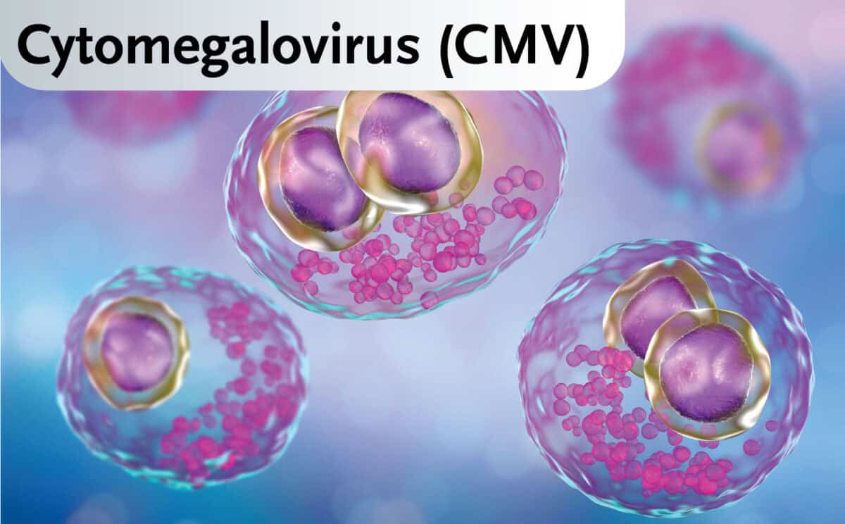 Cytomegalovirus-(CMV)
