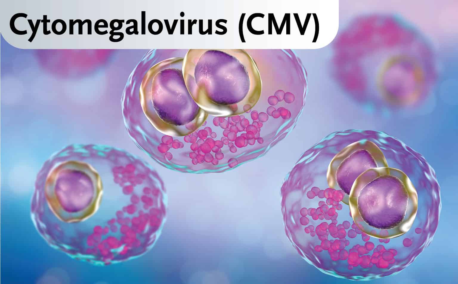 Cytomegalovirus (CMV)