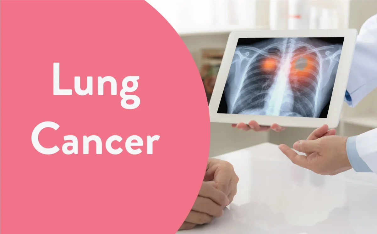 Lung Cancer