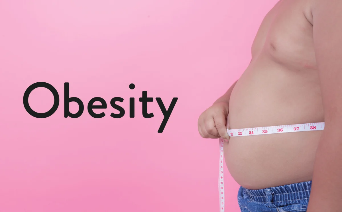 Obesity
