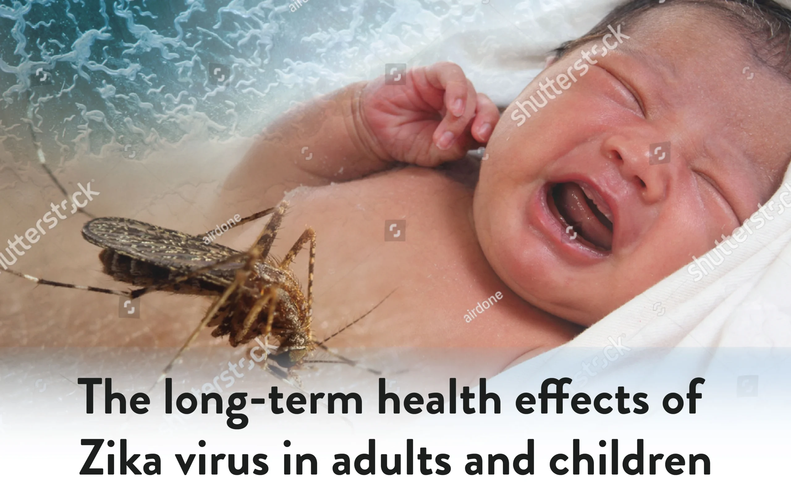 Potential Birth Defects Associated with Zika and The Long-Term Health Effects of Zika Virus in Adults and Children