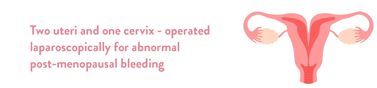 Two uteri and one cervix – operated laparoscopically for abnormal post-menopausal bleeding