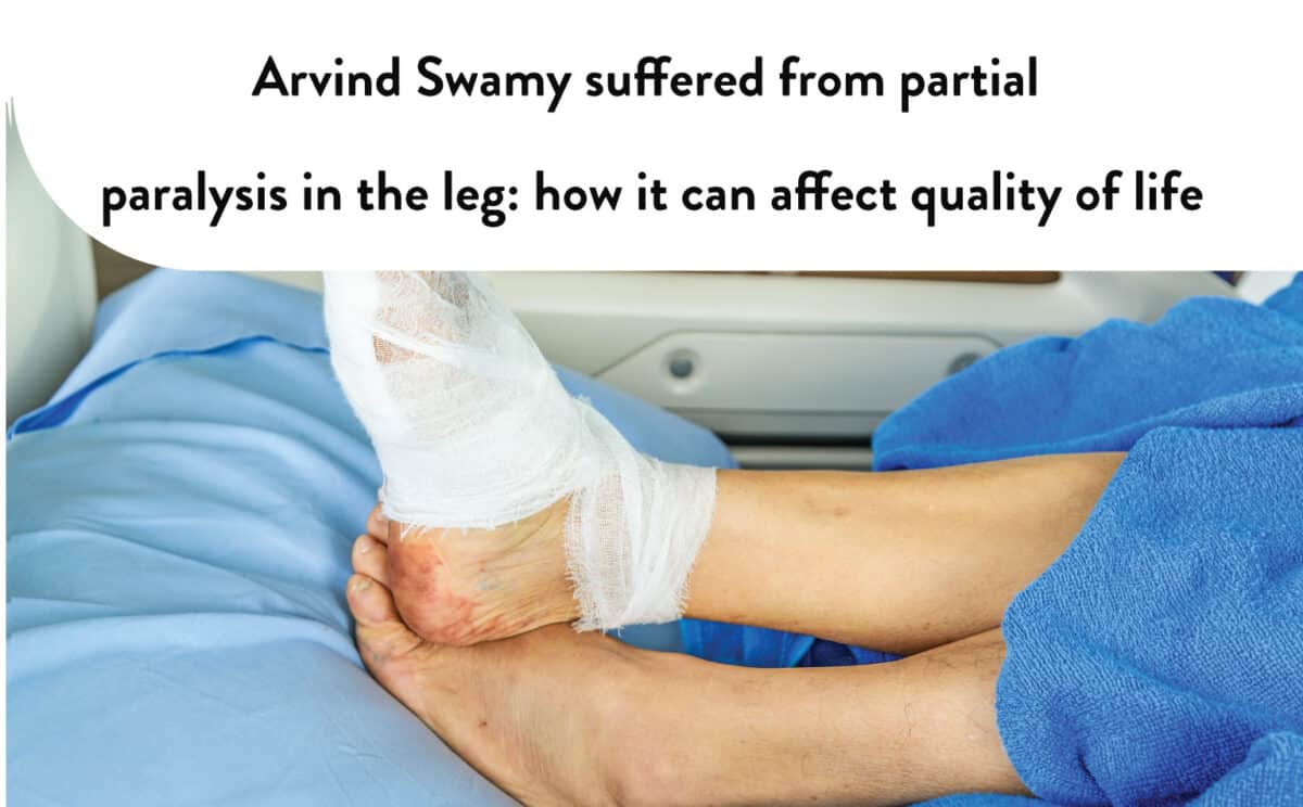 Partial-paralysis-in-the-leg-after-accident