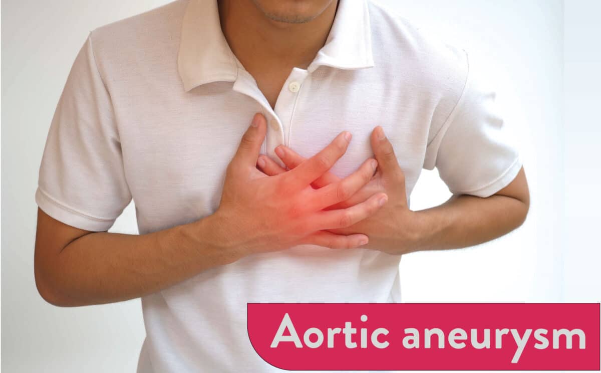 aortic-aneurysm