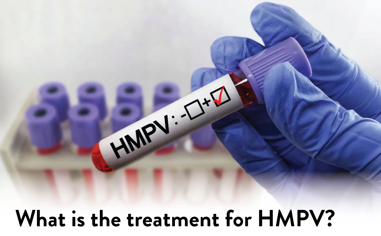 Treatment of hmpv